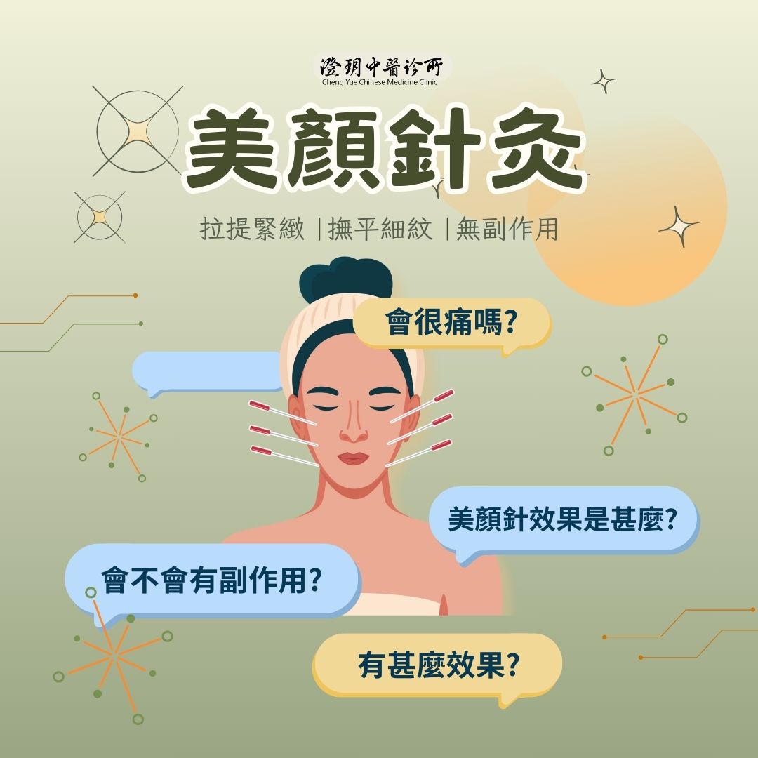 cheng yue_Facial_Acupuncture_cover